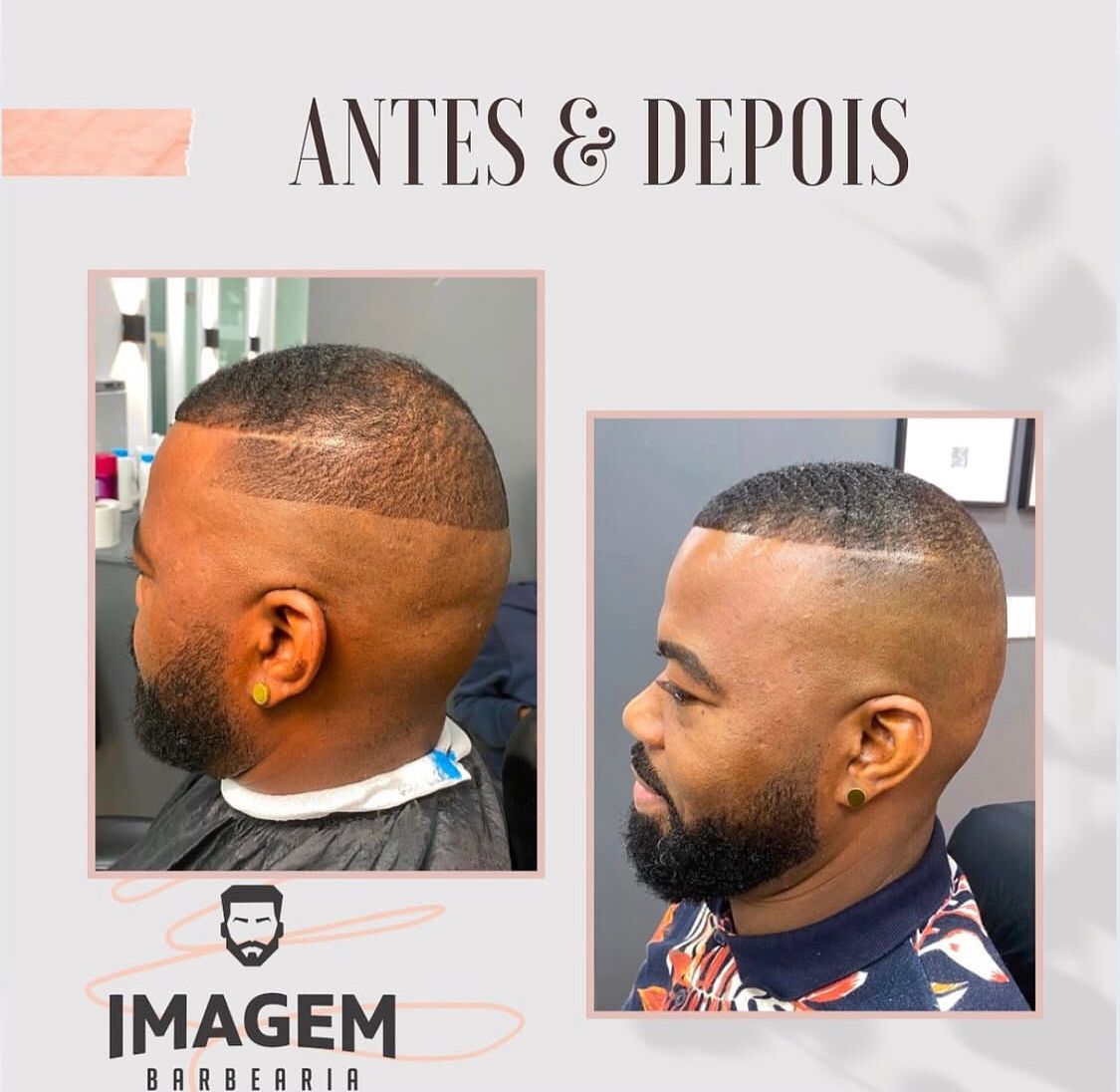 Antes e Depois 5